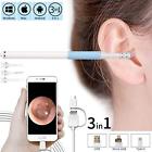 Sb122 Woage Ear Endoscope By Usb Borescope Inspection Camera 711531537629