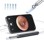 Ear Wax Removal Kit 1080P Hd Otoscope With Light Camera 6 Spoon For Iphone. Fixed Price $14.39.
